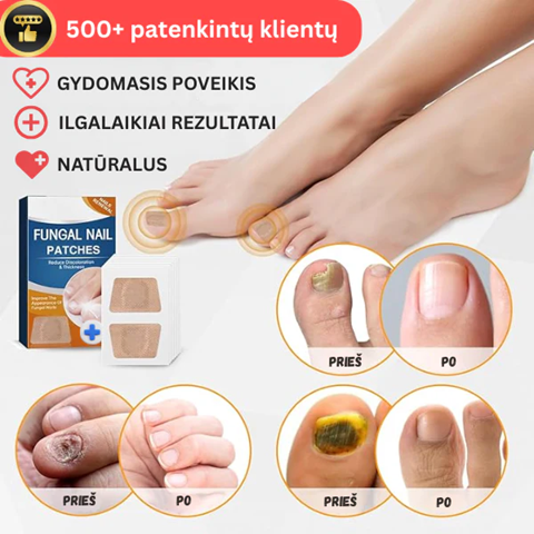 Ārstnieciskie plāksteri nagiem