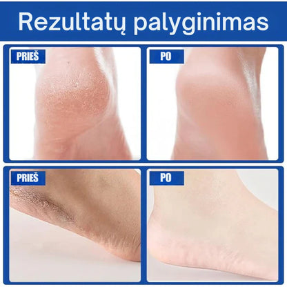 Mitrinošs un aizsargājošs kāju krēms